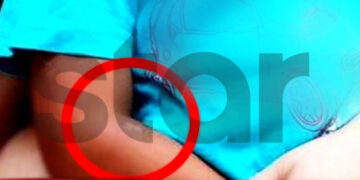 Φρίκη στη Λάρισα: Έσβηνε τσιγάρα πάνω στο κορμί των δύο παιδιών της