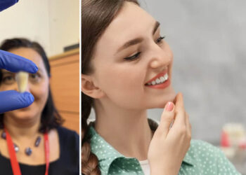 Ξεχάστε σφραγίσματα και εμφυτεύματα: Η νέα ανακάλυψη που αναγεννά τα δόντια με φυσικό τρόπο