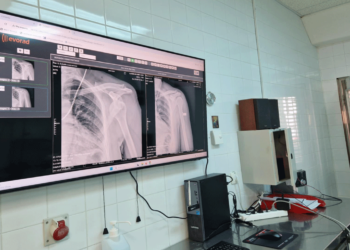 Νέες οθόνες για την προβολή ακτινογραφιών εγκαταστάθηκαν στο Μποδοσάκειο Νοσοκομείο Πτολεμαΐδας