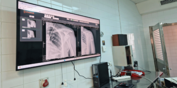 Νέες οθόνες για την προβολή ακτινογραφιών εγκαταστάθηκαν στο Μποδοσάκειο Νοσοκομείο Πτολεμαΐδας