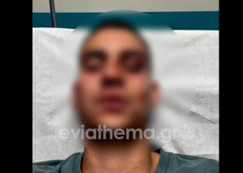 Σοκ στη Χαλκίδα: 18χρονος έστειλε στο νοσοκομείο 19χρονο για ένα… like (Βίντεο)