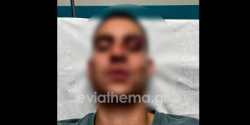 Σοκ στη Χαλκίδα: 18χρονος έστειλε στο νοσοκομείο 19χρονο για ένα… like (Βίντεο)