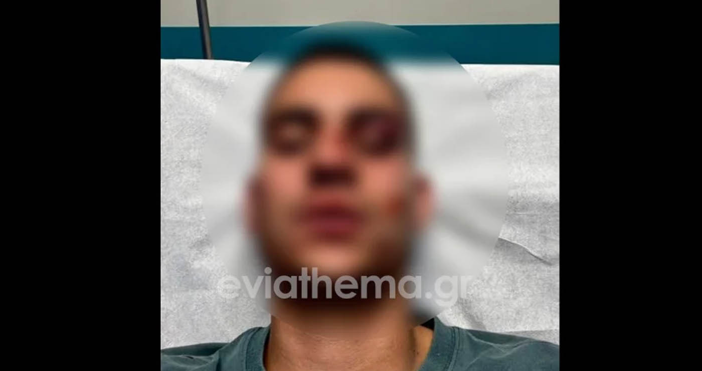 Σοκ στη Χαλκίδα: 18χρονος έστειλε στο νοσοκομείο 19χρονο για ένα… like (Βίντεο)