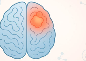 Γλοιοβλάστωμα: Η σημασία της έγκαιρης διάγνωσης