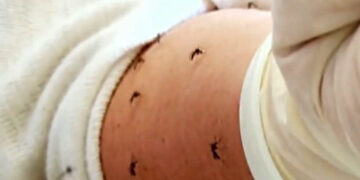 Συναγερμός από τον ΕΟΔΥ για τα κουνούπια – Προτείνει λήψη μέτρων (Βίντεο)