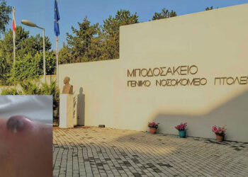 Μποδοσάκειο: Σωτήρια επέμβαση του Ιατρείου Αγγειακών Προσπελάσεων για 48χρονο ασθενή με ρήξη fistulas