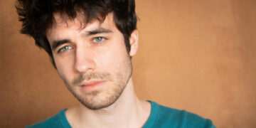 Μεταμόσχευση μαλλιών: Τι να περιμένεις τους πρώτους 6 μήνες