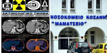 Ακτινολογικό Μαμάτσειου: Έγινε διαγνωστική βιοψία ήπατος σε ασθενή