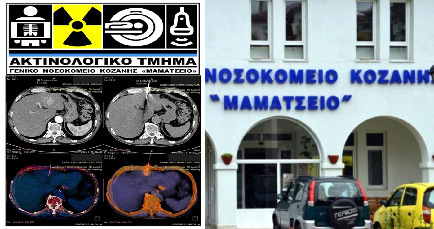 Ακτινολογικό Μαμάτσειου: Έγινε διαγνωστική βιοψία ήπατος σε ασθενή