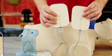 200 νέοι απινιδωτές σε δημόσιους χώρους στη Δυτική Μακεδονία – Επεκτείνεται το δίκτυο διάσωσης