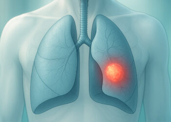 Καρκίνος Πνεύμονα: Όσα Πρέπει να Γνωρίζετε για τη Διάγνωση και τη Σύγχρονη Αντιμετώπιση